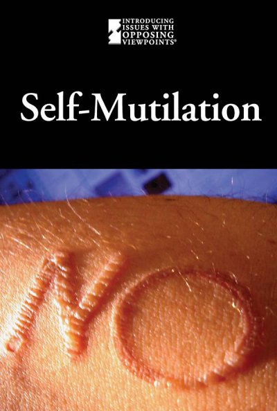 Self-mutilation / Mary E. Williams, book editor.